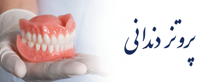 پروتز دندانی پروتز دندانی